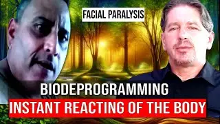 Facial Paralysis: Healing with Emotional Biodeprogramming 💖✨