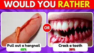 Would You Rather...? EXTREME Edition with Percentage % 🤔❓ HARDEST Choices Ever