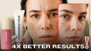 How [ Achromaxyl+ Sepithwite ] Gives 4X Better Results Then Hydroquinone In Short Period Of Time