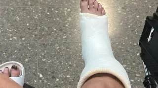 Mi peor accidente del año… hay que resurgir 🇨🇷