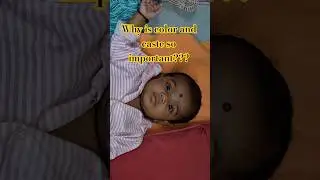 #razisstories #stopdiscrimination