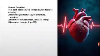 BME-390 | Biomedical Signal Analysis &ndash; ECG | Student Presentation 2