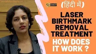 Laser Birthmark Removal Treatment (in HINDI) by Dr Rinky Kapoor, Mumbai, India