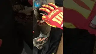 Seal With Severe Rope Entanglement [GRAPHIC] #shorts
