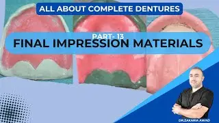 13 - مواد أخذ الطبعة النهائية - FINAL IMPRESSION MATERIALS