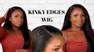 The Most Realistic Kinky Edges Ventilated Wig| It's Giving Scalp!!! ft. ILIKEHAIR