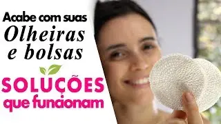 O FIM das olheiras e BOLSAS nos olhos | Tratamento Natural EFETIVO e ANTI-MANCHAS