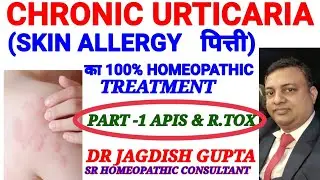 SKIN ALLERGY||URTICARIA ,Homeopathic treatment #doctor #urticaria #homeopathy #latest #tranding#SKIN