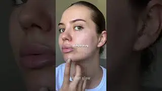 🍬 This Food Causes Acne! Shocking Skincare Diet Truths