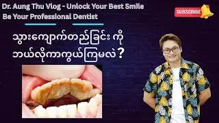 သွားကျောက်တည်ခြင်းကိုဘယ်လိုကာကွယ်ကြမလဲ ?
