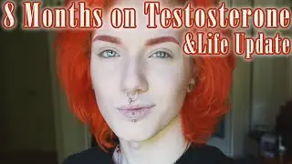 Ascher Lucas | 8 Months on Testosterone & Life Update