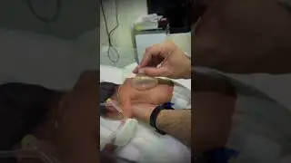 Tactile stimulation of Newborn😥 #ytshorts #newbornbaby #viralshorts