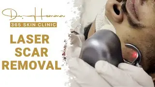 Best Laser Scar Removal at Gurugram | Laser Treatments | Best Skin & Hair, Laser Clinic In Gurugram