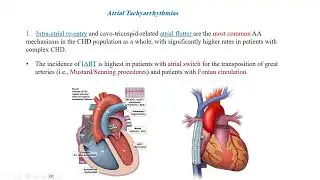 1 Arrhythmias in Congenital Heart Diseases Dr Eman Farghaly