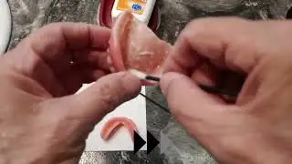 FINALLY I CAN EAT AGAIN!