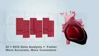 Wincomm AI ECG Solutions - Intel Medical Edge AI Market Ready Solutions