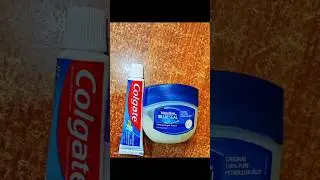 Vaseline and Colgate for removal of scars