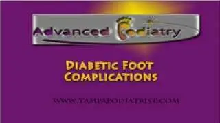 Foot Diabetes Complications