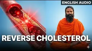 Reverse High Cholesterol Naturally with Yoga & Ayurveda