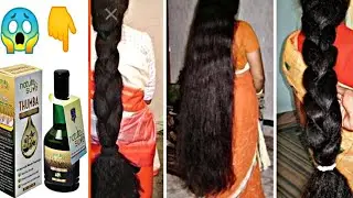 THUMBA Wonder hair oil |Treat Alopecia, Dandruff,Hair fall, Hair loss,Split Ends & Baldness at Home?