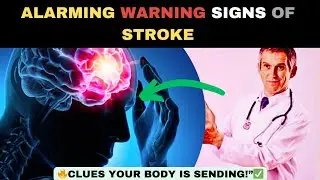 ⚠️ 7 Silent Stroke Signs Most People Ignore Until It's Too Late- Doctors Warn