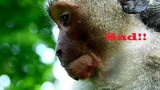 breaking -heart !!! Can't stop pity on orphan Jessie, Feel so sad cos almost can't eat cos painful