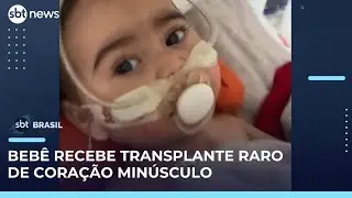 Bebê de 9 meses recebe transplante raro de coração em São Paulo | #SBTBrasil