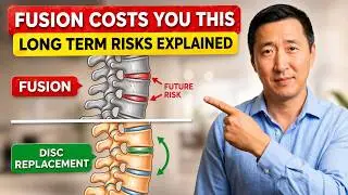 Cervical Disc Replacement vs Fusion: Which Is Right for Your Neck? | Spine Surgeon Explains