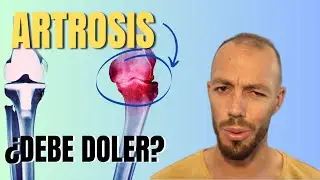 🤫¿Te han contado ESTO sobre la ARTROSIS Generalizada en ADULTOS MAYORES? Descubre por qué duele.