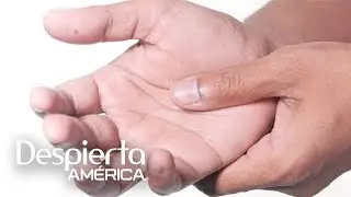 Dolor de manos: los m&eacute;dicos responden sobre posibles causas, consecuencias y remedios | DA