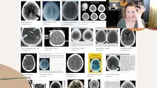 An Intro to German New Medicine Part 3: Dr. Hamer's Discovery