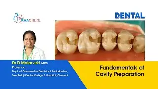 Fundamentals of Cavity Preparation