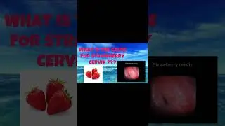 Did You Know? The Startling Reality of Strawberry Cervix | #shorts #cervix #medicine