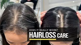 Hair Loss Products: Do They Really Work? The Best Korean Hair Loss Recommendations