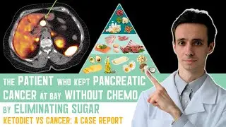Fueling Hope: How One Patient Used a Keto Diet Alongside Pancreatic Cancer Treatment