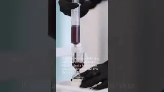 At Skin Atelier Kilchberg, we offer natural and innovative filler treatments available: Plasma Gel.