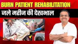 जले मरीज छुट्टी के बाद घरेलू सावधानियाँ | Burn Rehabilitation After Hospital Discharge Recovery Tips
