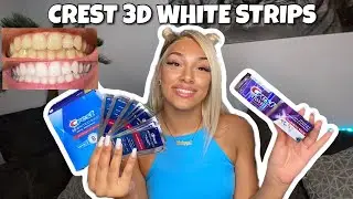 ICH TESTE DIE CREST 3D WHITE STRIPS 14 TAGE 🦷 *honest review
