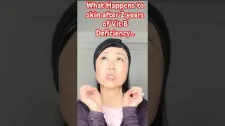What Happens to Skin after 2 yrs of Vit B Deficiency #goseechristy