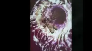DR 