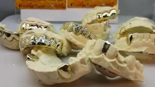 Grillz by @ar_diamonds toronto, Brampton Ontario Canada