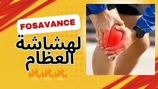 Fosavance: الحل السحري لمكافحة هشاشة العظام بسرعة!🦴💊🔥