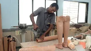 Mahavir Seva Sadan Provides Free Prothestic Legs!