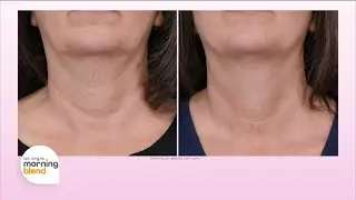 Say Goodbye to Crepey Neck Skin | Dekliderm&rsquo;s Anti-Aging Breakthrough for 50+ Skin