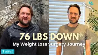 I LOST 76 POUNDS! | Sharing my Weight Loss Journey with Duodenal Switch (SADI-S)