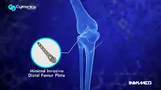 Invamed Cytronics&reg; Orthopedic Products