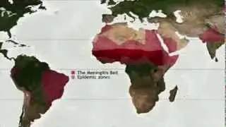 Meningitis in Chad