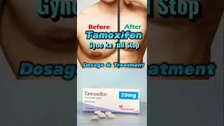 Tamoxifen Gyno ka Full Stop Dosage & Treatment 2025 #steroidcycle #tamoxifen #ytshorts #shorts #yt