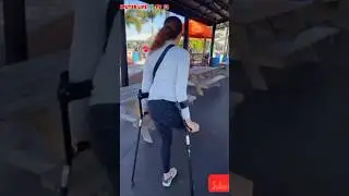 Женщина с ампутированной конечностью, ходящая на костылях, помогает в борьбе с потерей конечностей.