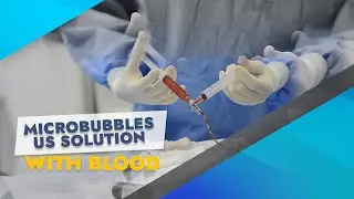 Microbubbles US Solution with Blood